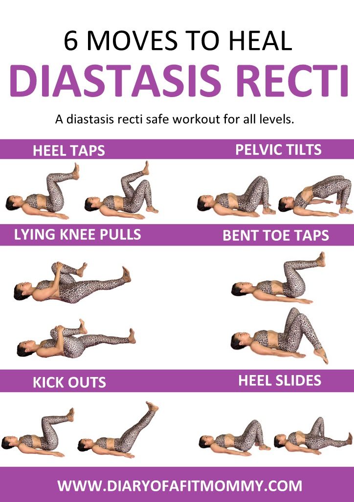 4 Diastasis Recti Exercises That Heal & Strengthen Your Injured Core