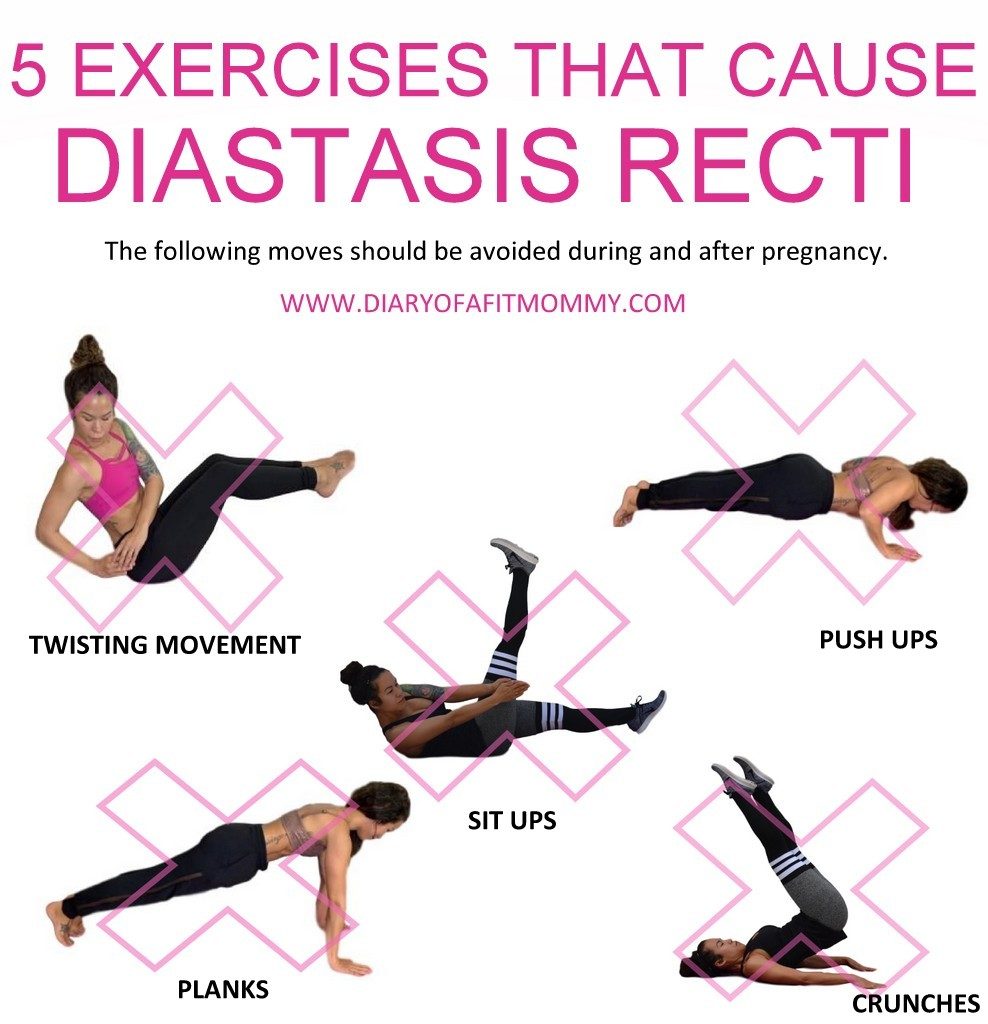 Leg slides outlet for diastasis recti