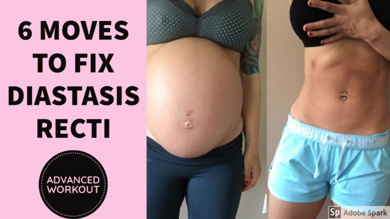 6-Minute Diastasis Recti Exercises: Safe and Effective Diastasis Recti  Exercise to Heal Abdominal Separation, Eliminate Belly Bulge, and Close  Postpartum Gap - Kindle edition by Ryan, Celia . Health, Fitness & Dieting