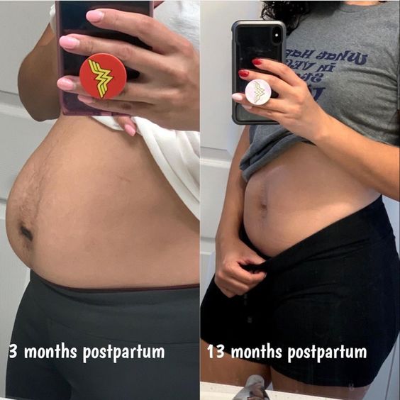 One month postpartum diastasis update after baby #2 and Bellies Inc  postpartum recovery belly system